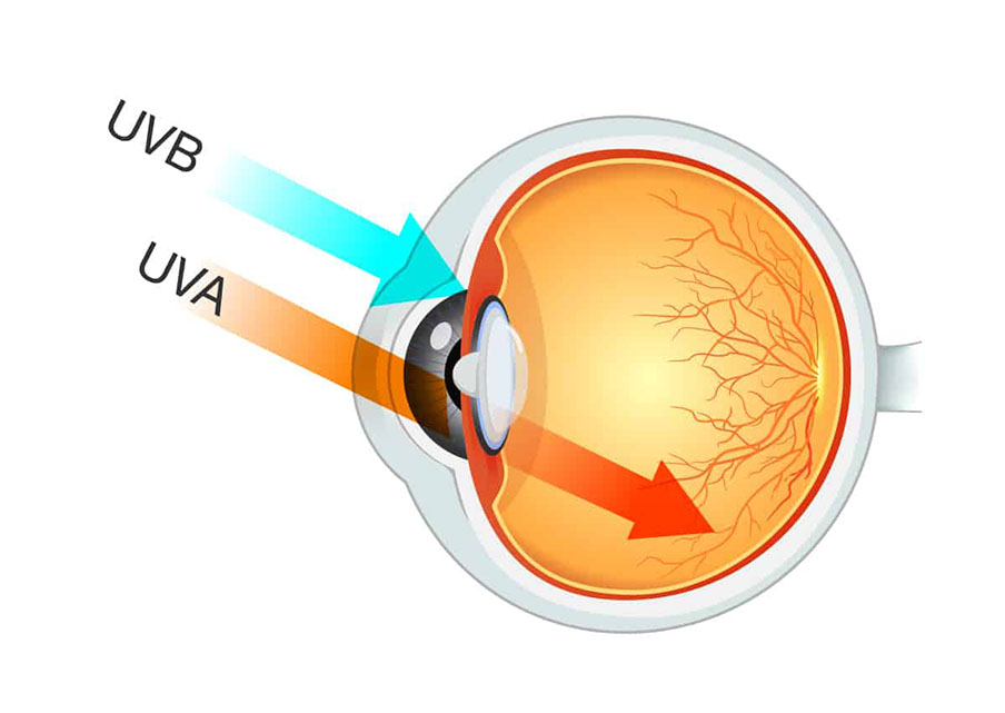 Az UV a retinát is elérheti 